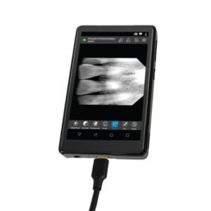Portable Digital Imaging System (Mp4)
